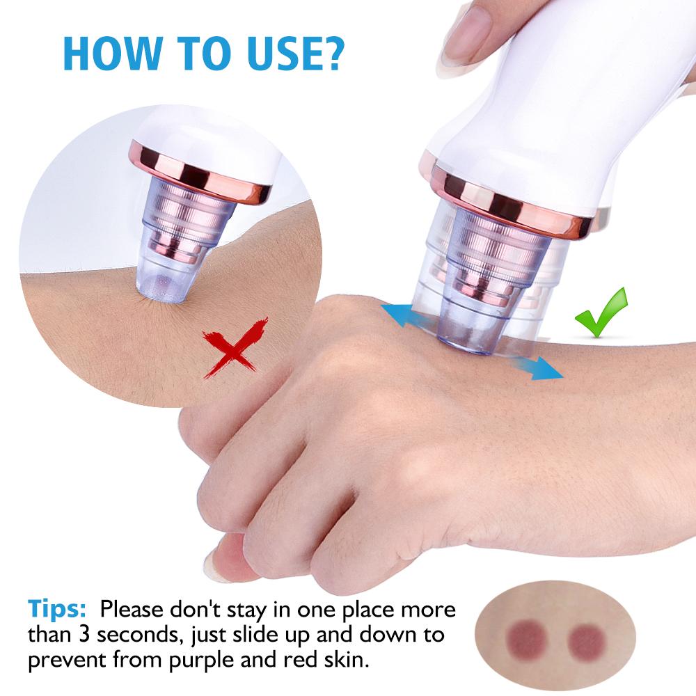Blackhead Remover Vacuum Pore Cleaner Suction Cleaning Face Care Black Head Cleaner Acne Extractor Diamond